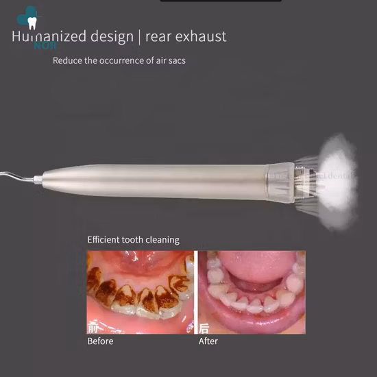 Стоматологический воздушный скалер Kavo Type Air Scaler Polishin Tools Очиститель для отбеливания зубов с 3 насадками
